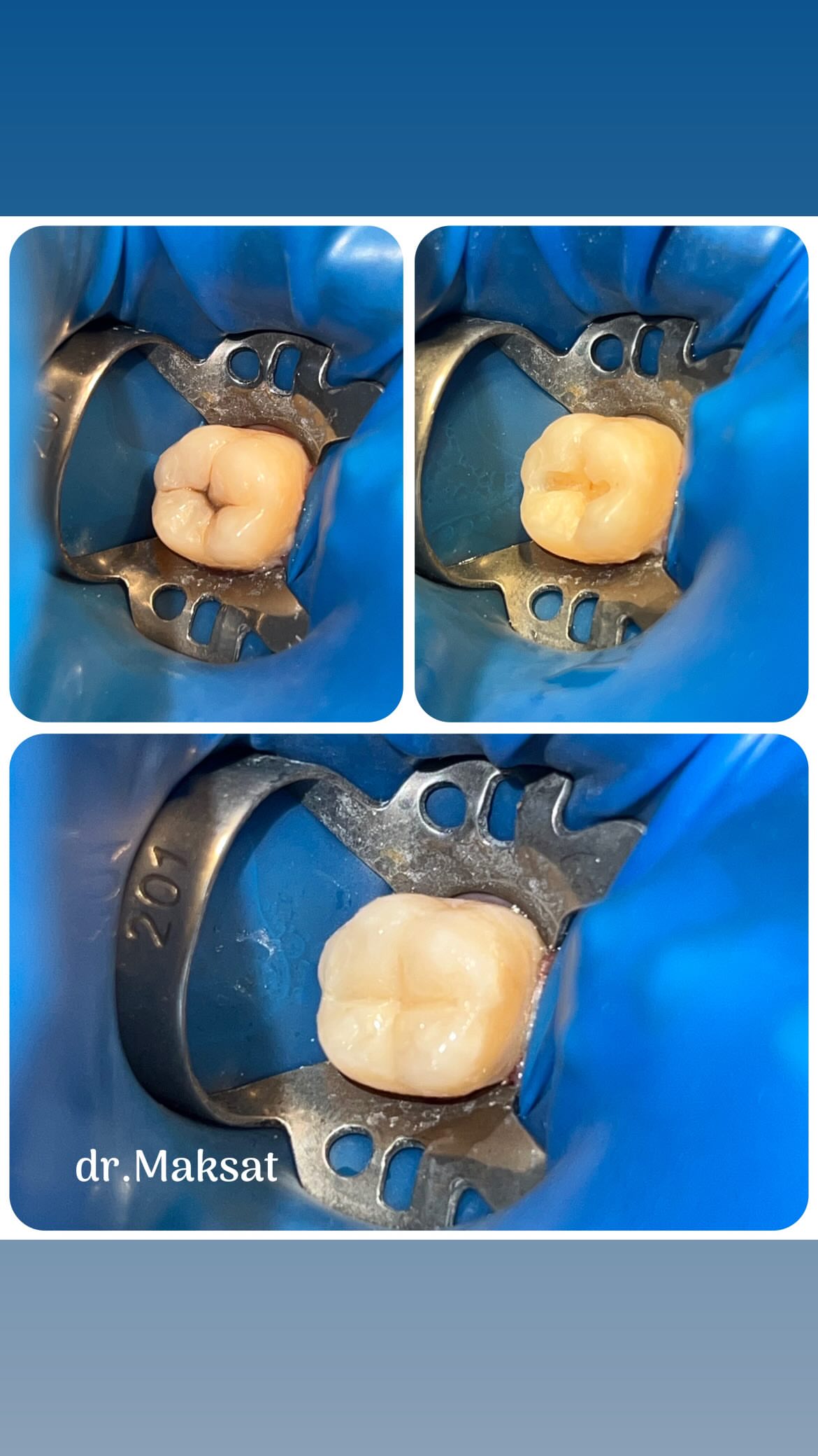 Работы стоматолога