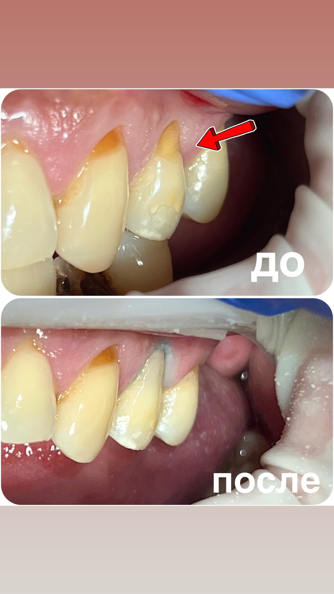 Работы стоматолога